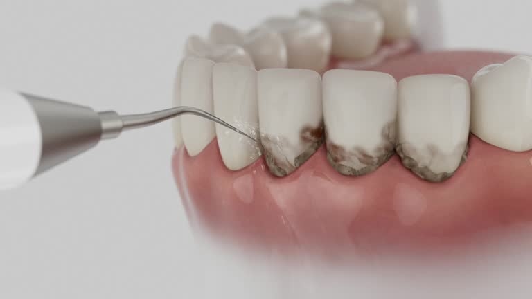 Trusted Tooth Extraction service in Lake Wisconsin, WI - Dentist Open Now